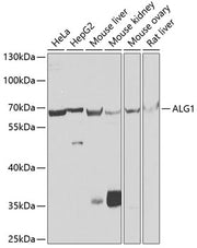 ALG1 Rabbit pAb