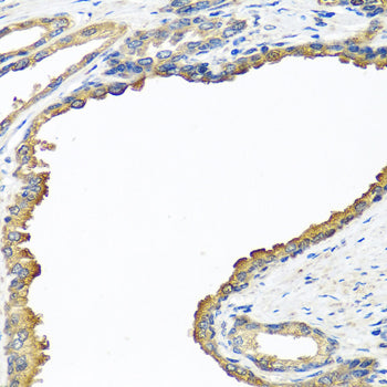 NYX Rabbit pAb