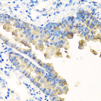 NYX Rabbit pAb