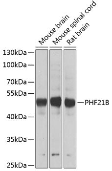 PHF21B Rabbit pAb