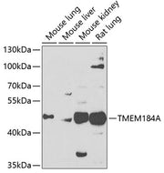TMEM184A Rabbit pAb