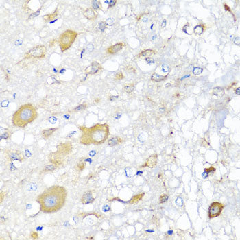 CALHM1 Rabbit pAb