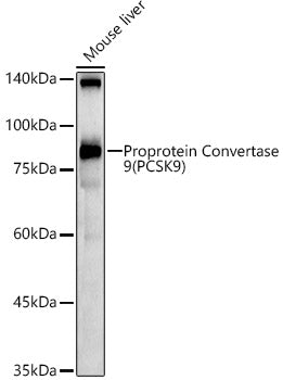Proprotein Convertase 9(PCSK9) Rabbit pAb
