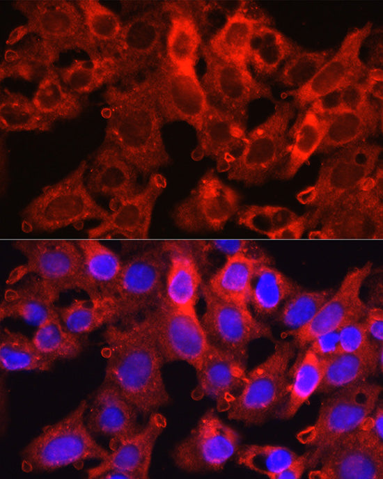 Proprotein Convertase 9(PCSK9) Rabbit pAb