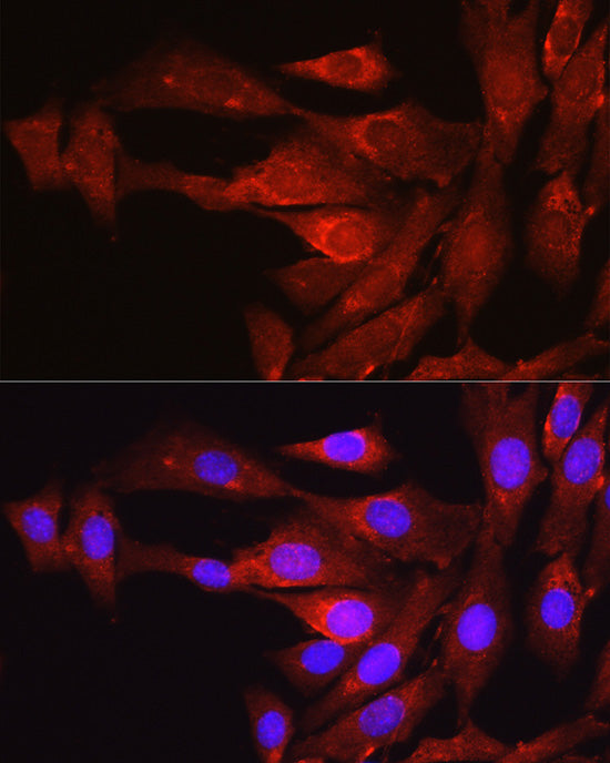 Proprotein Convertase 9(PCSK9) Rabbit pAb