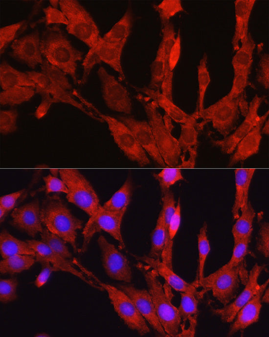 Proprotein Convertase 9(PCSK9) Rabbit pAb