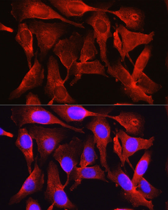 Proprotein Convertase 9(PCSK9) Rabbit pAb