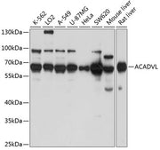 ACADVL Rabbit pAb