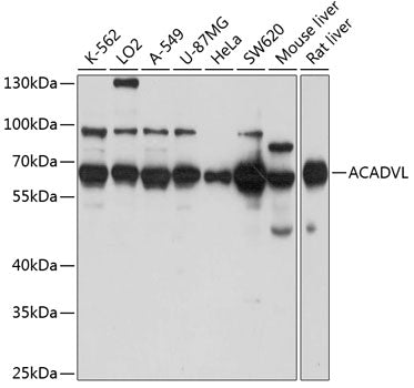ACADVL Rabbit pAb