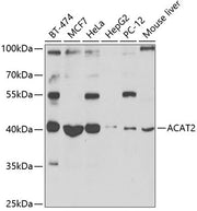ACAT2 Rabbit pAb