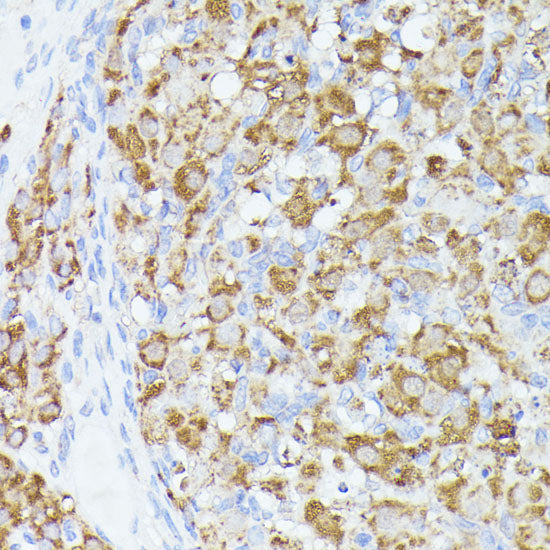 ACAT2 Rabbit pAb