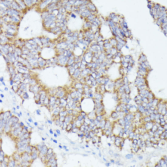 ACAT2 Rabbit pAb