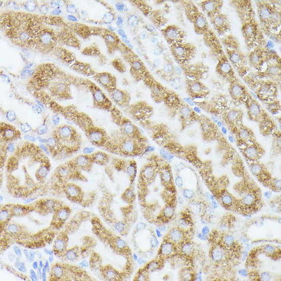ACAT2 Rabbit pAb