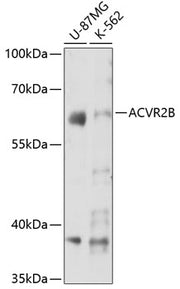 ACVR2B Rabbit pAb