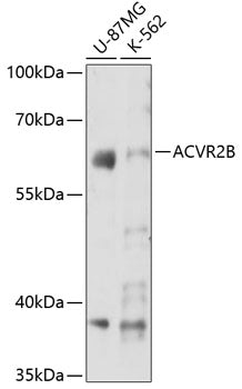 ACVR2B Rabbit pAb