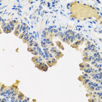 ANGPT1 Rabbit pAb