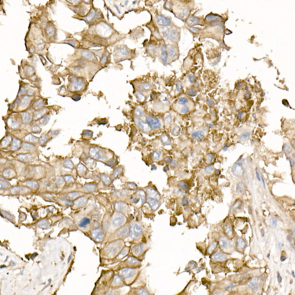 Na+/K+-ATPase Rabbit pAb