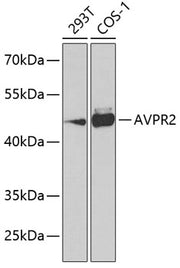 AVPR2 Rabbit pAb
