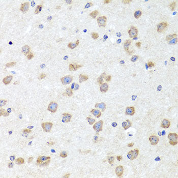 [KO Validated] CHD1 Rabbit pAb