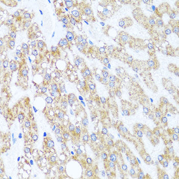 [KO Validated] CHD1 Rabbit pAb