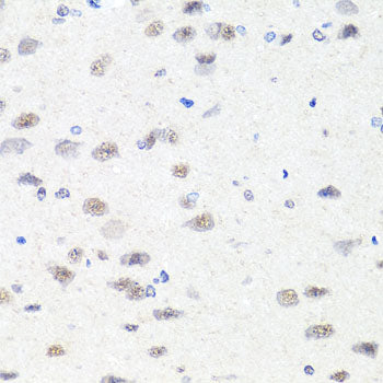 [KO Validated] CHD1 Rabbit pAb