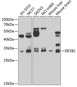 EIF2B1 Rabbit pAb