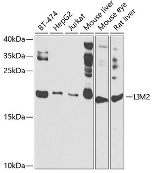 LIM2 Rabbit pAb