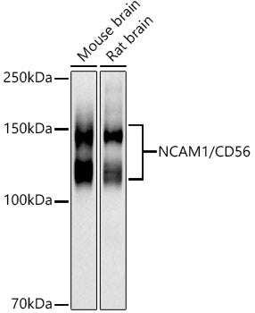 NCAM1 / CD56 Rabbit pAb