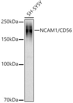 NCAM1 / CD56 Rabbit pAb