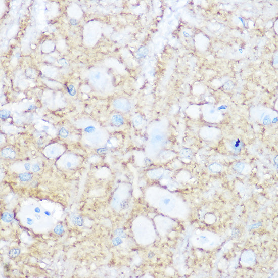 NCAM1 / CD56 Rabbit pAb