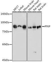 PFKP Rabbit pAb