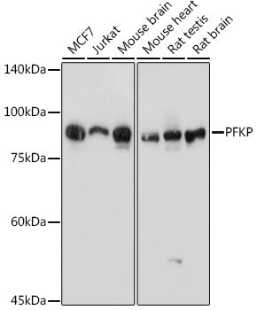 PFKP Rabbit pAb