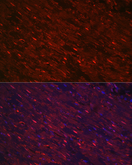 PGAM2 Rabbit pAb