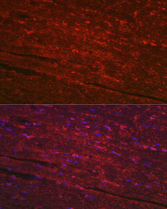 PGAM2 Rabbit pAb