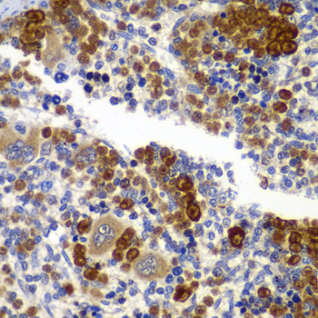 AMPKβ1 Rabbit pAb