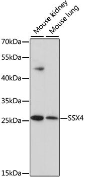SSX4 Rabbit pAb