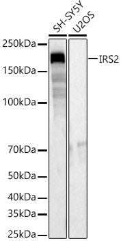 IRS2 Rabbit pAb