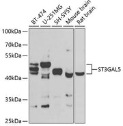 ST3GAL5 Rabbit pAb