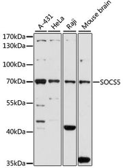 SOCS5 Rabbit pAb