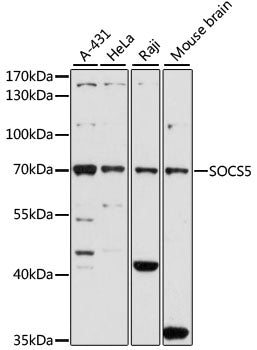 SOCS5 Rabbit pAb