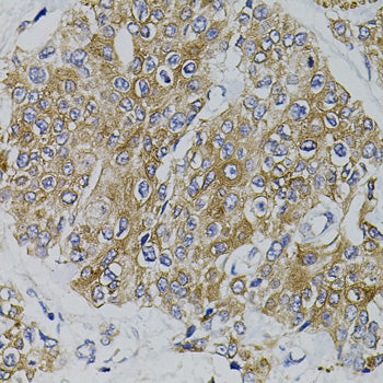 ARHGEF11 Rabbit pAb