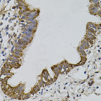 ARHGEF11 Rabbit pAb