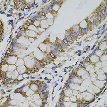 ARHGEF11 Rabbit pAb