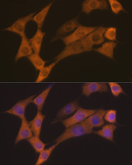 Cyclin B2 Rabbit mAb