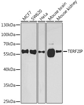 TERF2IP Rabbit pAb