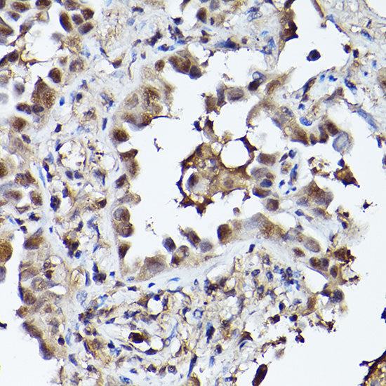 PHD3 Rabbit pAb