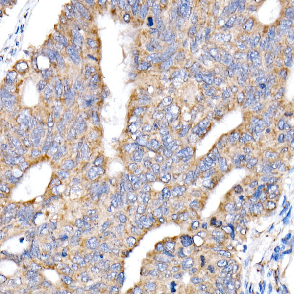 NDUFV1 Rabbit pAb