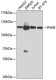 PHKB Rabbit pAb