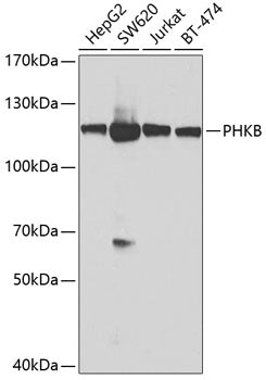 PHKB Rabbit pAb