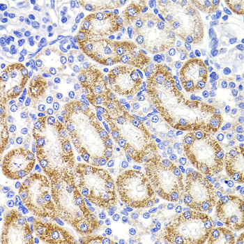 HMGCL Rabbit pAb